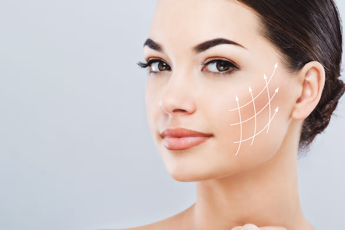 Lifting du visage