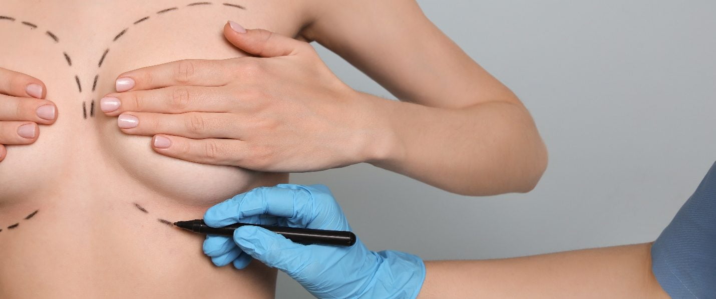 A cosmetic surgeon drawing on the breast area with a marker.
