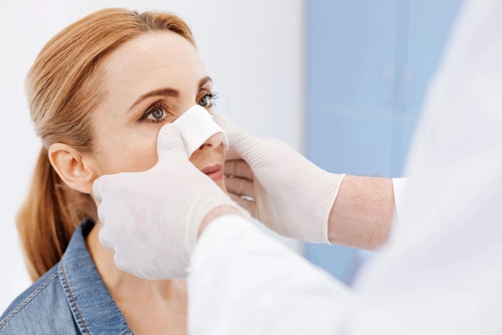 rhinoplasty