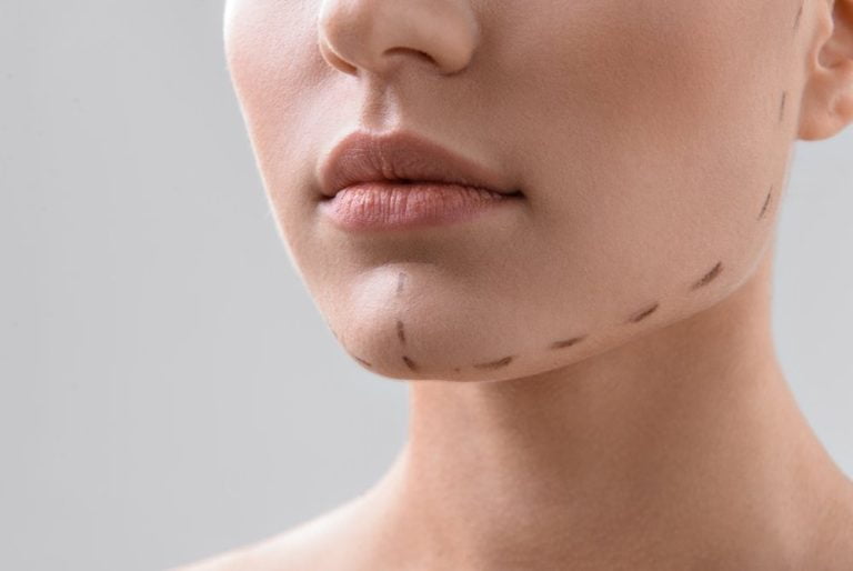 Гениопластика