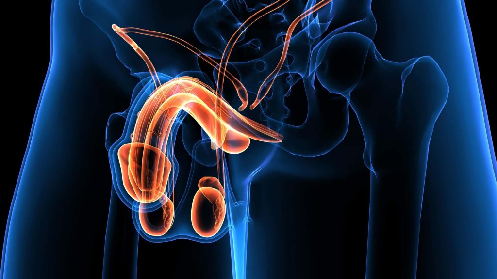 Penile Extension Surgery