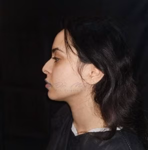 Een zijprofielfoto van een persoon met lang donker haar, poserend tegen een zwarte achtergrond. De foto is van Dr. MFO en heeft betrekking op gezichtsfeminisatiechirurgie.