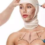 ffs gezichtsfeminisatiechirurgie procedures