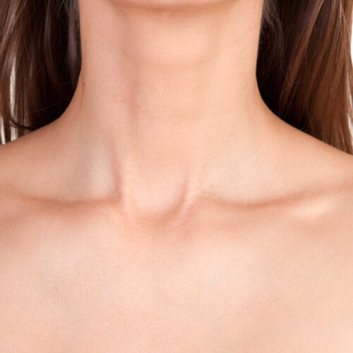 Tracheal Shaving Surgery