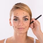 lifting facial, mini lifting facial