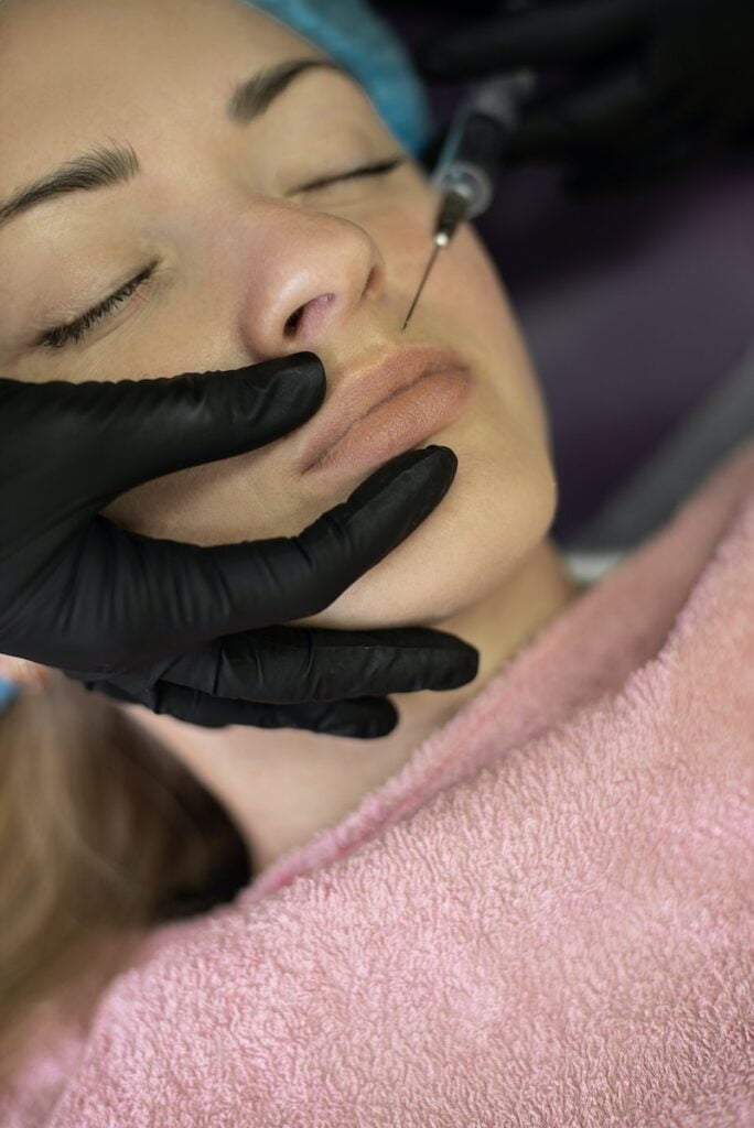 Donna che ha iniettato Botox, botox