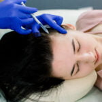 Une esthéticienne pratique une mésothérapie capillaire sur une cliente. Allongée, les yeux fermés, l'esthéticienne, portant des gants bleus, injecte une solution dans son cuir chevelu à l'aide d'une seringue.