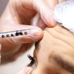 une femme se fait examiner les sourcils par un médecin, du botox