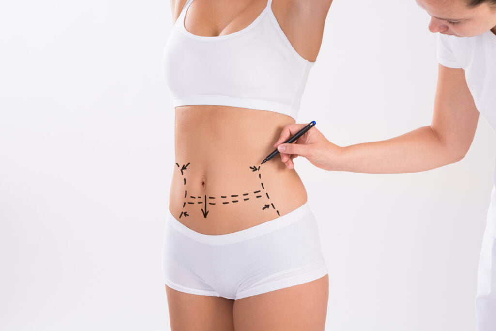 Tummy Tuck in Antalya: How to Get a Flat and Firm Belly with Minimal Scarring