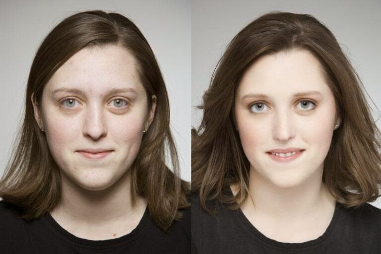 Каков минимальный возраст для операции по феминизации лица?