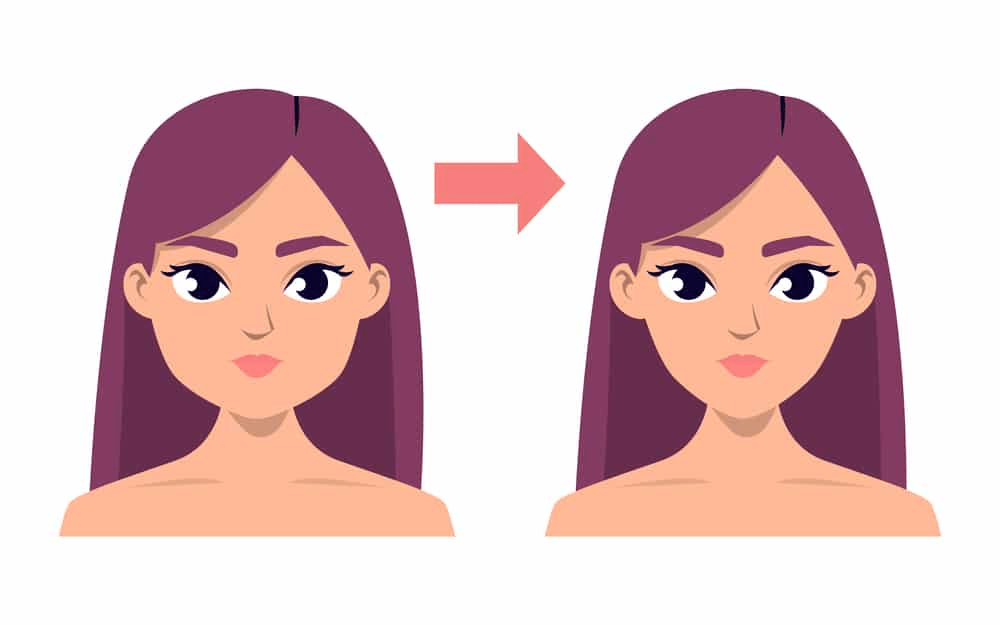 كم تكلفة عملية v line في تركيا؟