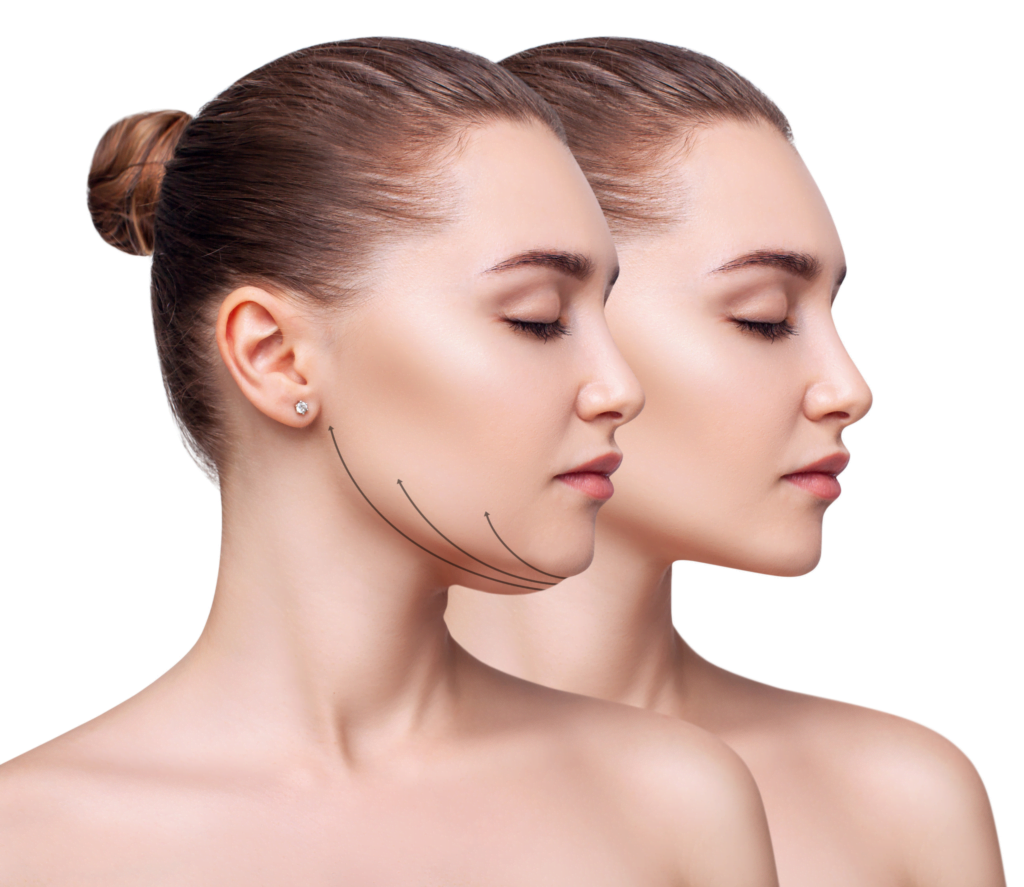 How much does chin feminization surgery cost?
