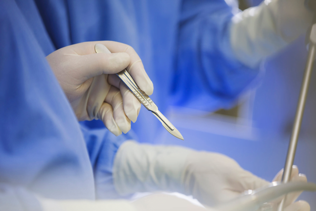 A close-up of a gloved hand holding a scalpel during a surgical procedure in an operating room, highlighting the precision and sterile environment.