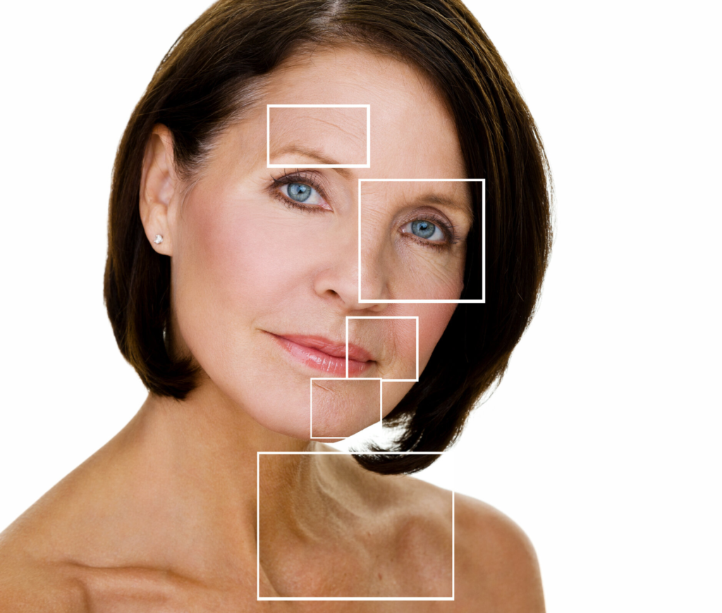 Mini lifting facial: una forma rápida y eficaz de renovar tu apariencia 3