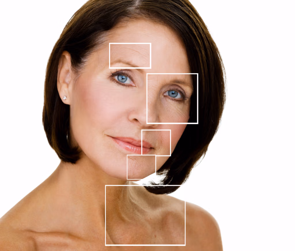 Fotografía de una mujer con zonas resaltadas que muestran signos de envejecimiento, incluyendo arrugas alrededor de los ojos, la frente y el cuello.