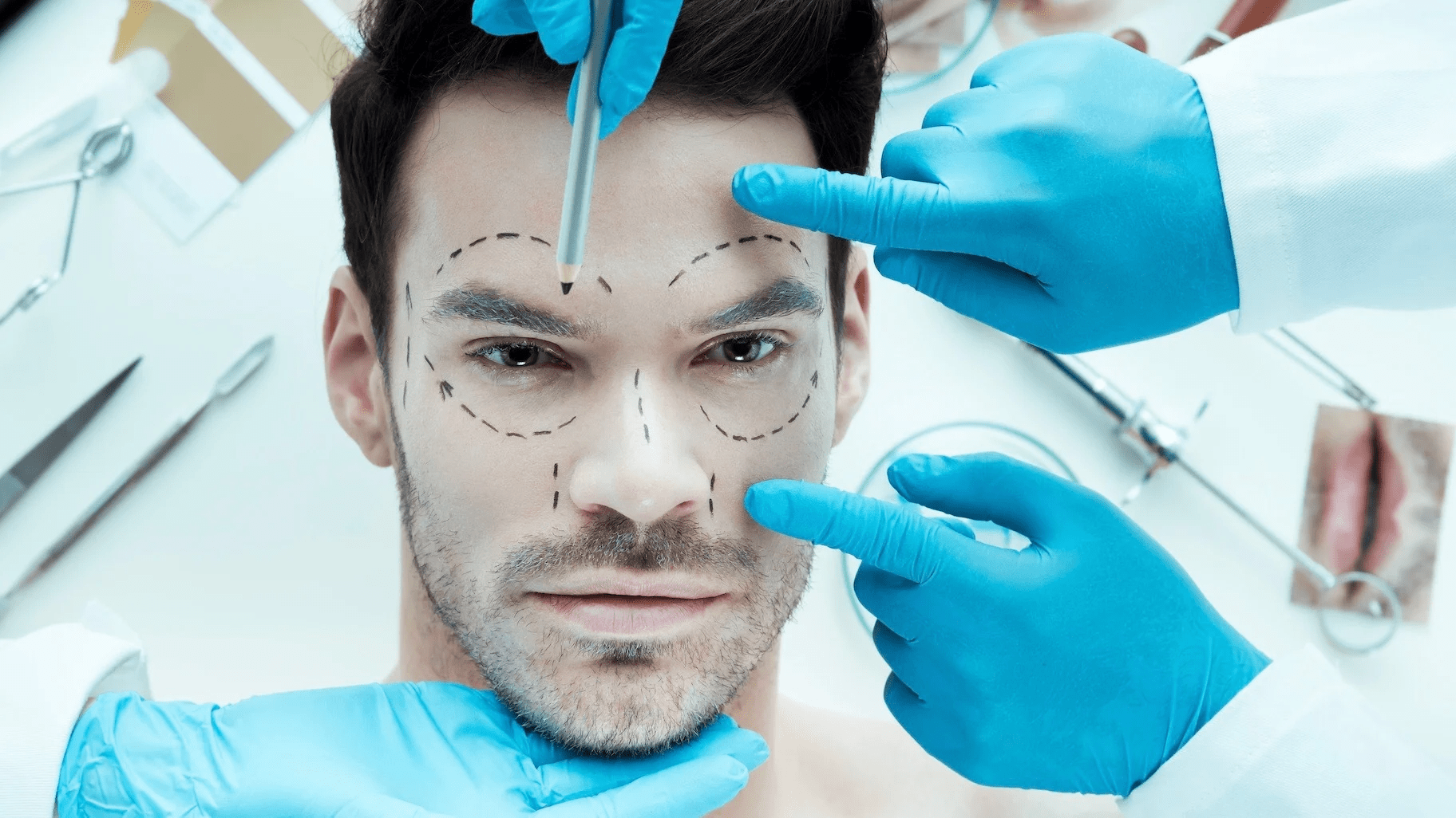 A man lying on a medical table with surgical markings on his face, surrounded by medical professionals wearing blue gloves and holding surgical tools.