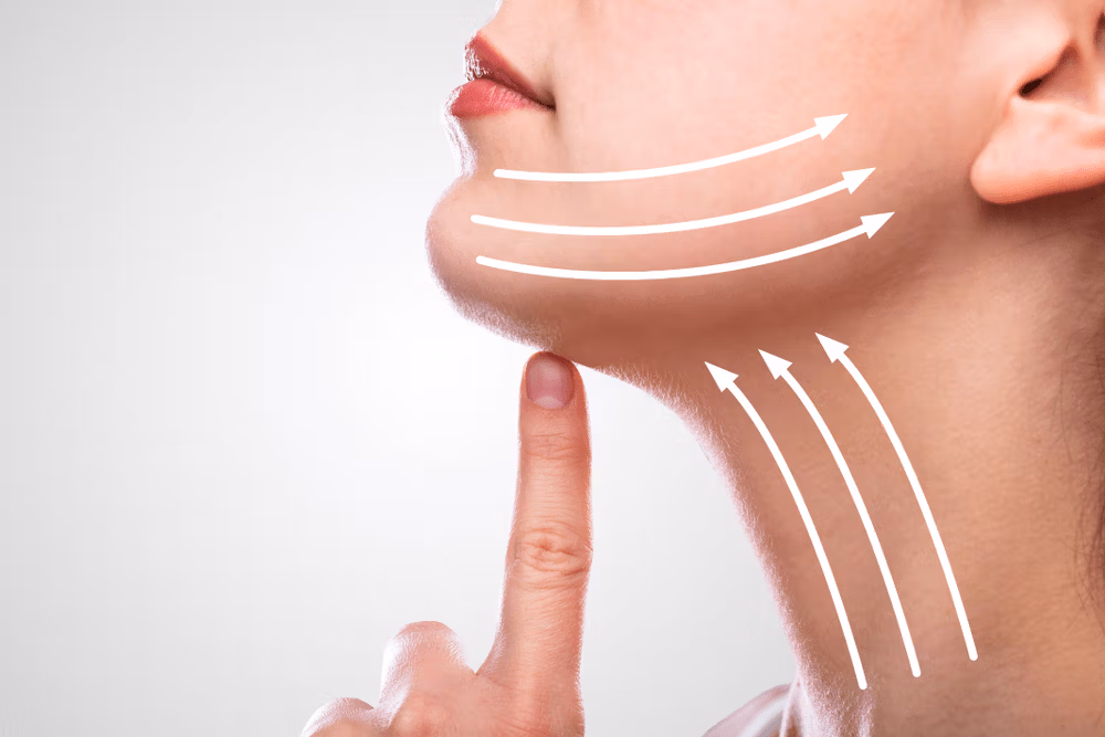 Un'immagine ravvicinata della parte inferiore del viso di una persona, con frecce che puntano lungo la mandibola e il collo, indicando le aree su cui concentrarsi per un intervento estetico o un esame.