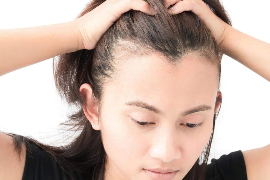 ¿Es normal la línea del cabello en forma de M?