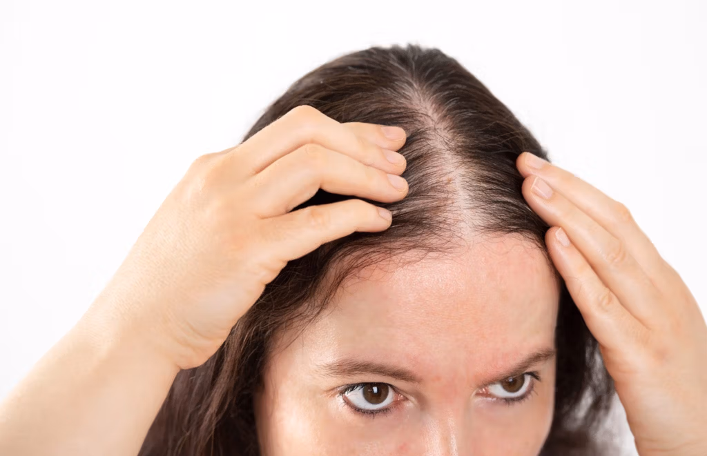 Which Country is Best for Hair Transplant?