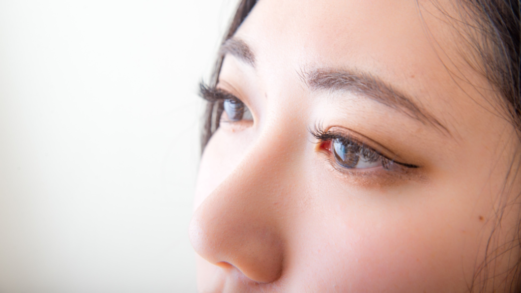 Was ist die bessere Kanthopexie oder Kanthoplastik?