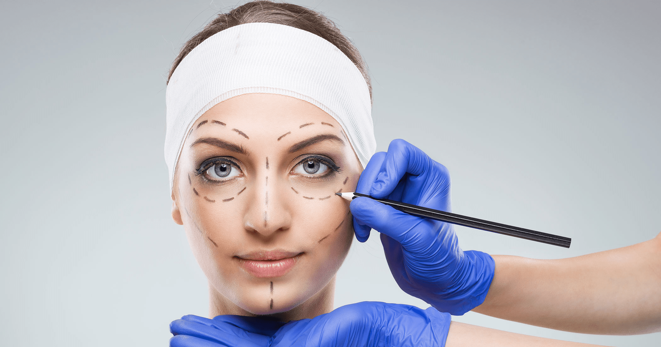 A medical professional in blue gloves marks a patient's face with lines, likely preparing for a cosmetic procedure such as facial surgery.