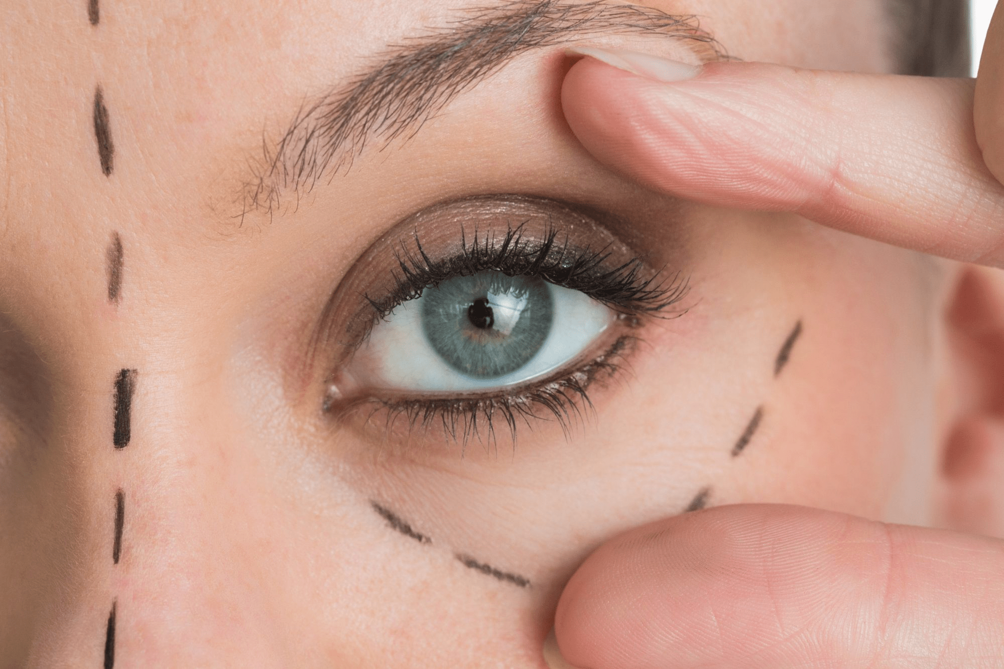 Cat Eye Surgery Prices in Turkey: Why Should You Choose Turkey?