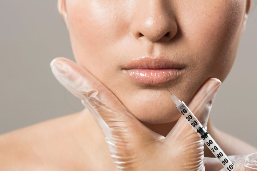 Do Lip Fillers Go Away? A Comprehensive Guide 4