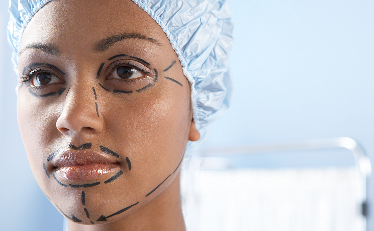 A person wearing a surgical cap with pre-operative markings on their face, likely preparing for a cosmetic procedure.