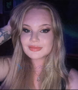 A close-up portrait of a person with long blonde hair, light makeup, and a slight smile. The person is wearing a necklace and has a tattoo on their left arm. The image includes a watermark for Dr. MFO Facial Surgery & Beauty.