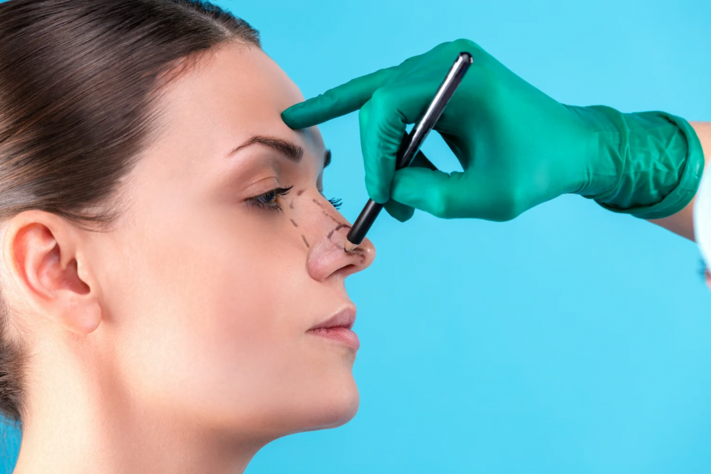 A doctor in green gloves uses a marker to draw lines on a patient's nose, likely preparing for a rhinoplasty procedure.