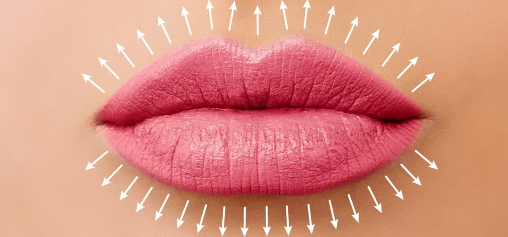 Aumento de labios: todo lo que necesita saber para mejorar su sonrisa