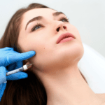 Une femme reçoit une injection cosmétique dans la mâchoire de la part d'un professionnel de la santé portant des gants bleus