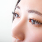 10 faits surprenants sur la canthopexie qui vous surprendront !