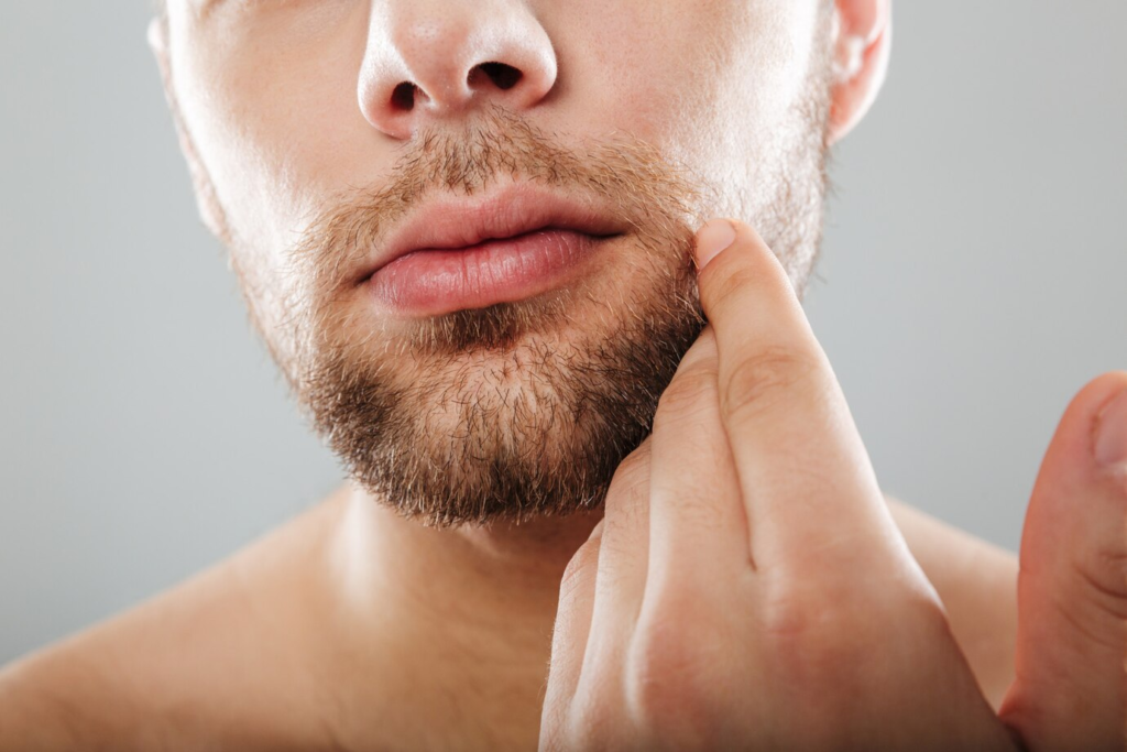 ¿Son atractivas las mandíbulas anchas? ¿Cómo puedes convertirte en un hombre más atractivo con la Cirugía de Masculinización Facial?