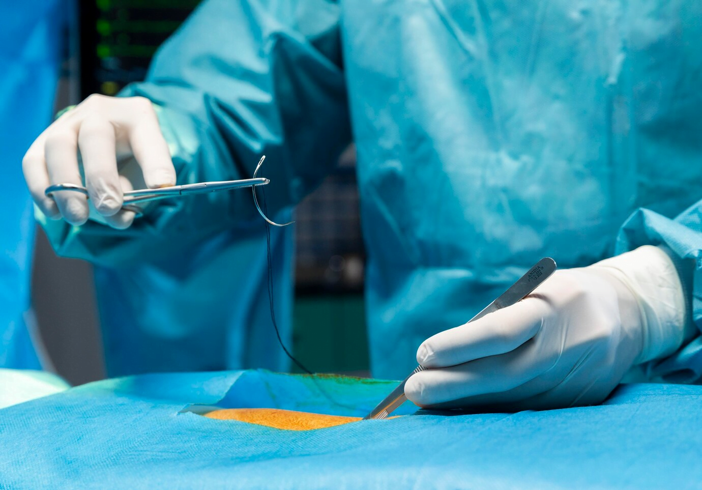 أفضل العمليات الجراحية في المملكة المتحدة مقابل تركيا: معضلة التكلفة والجودة؟