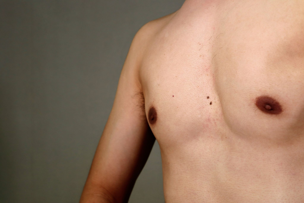 FtM Top-chirurgie betaalbaarheid: uw reis begint hier!