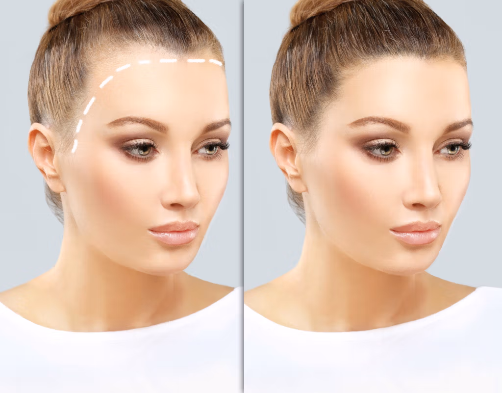 Before and after comparison of a woman's face, showcasing the application of makeup. The left side shows the face with makeup guidelines drawn, while the right side displays the finished makeup look with contoured cheeks, highlighted features, and defined eyebrows.