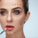 Een vrouw met chirurgische markeringen op haar gezicht, die wijzen op de voorbereiding op een cosmetische ingreep, met lijnen en pijlen rond haar ogen, jukbeenderen en kin. Ze draagt make-up, met de nadruk op haar ogen en lippen, en een chirurgisch instrument is bij haar kin geplaatst.