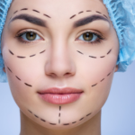 Een vrouw draagt een blauwe operatiemuts met zwarte stippellijnen op haar gezicht. Waarschijnlijk bereidt ze zich voor op een cosmetische of chirurgische ingreep.