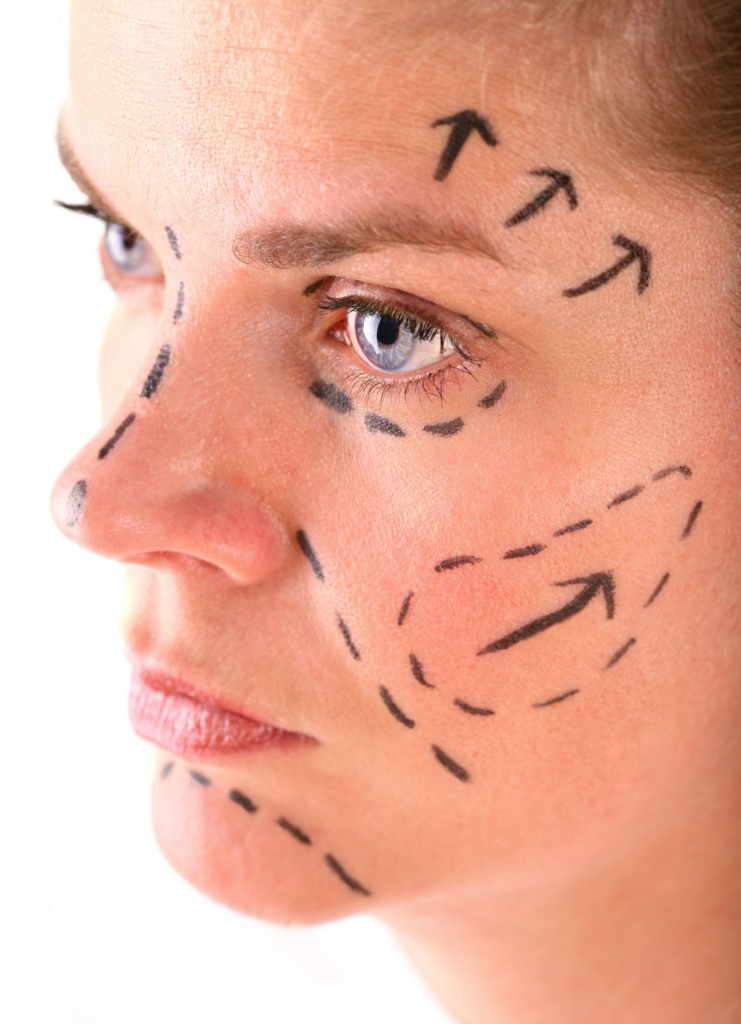 Why is Turkey the best for plastic surgery? 10 Reasons to Choose Turkey for FFS Surgery 1