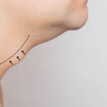 Illustration anatomique montrant les sites d'incision d'augmentation mammaire, probablement à des fins pédagogiques ou médicales. L'image met en évidence les zones précises où sont pratiquées les incisions chirurgicales, indiquées par des flèches le long d'une ligne pointillée, indiquant le trajet de l'incision sur le côté du sein.