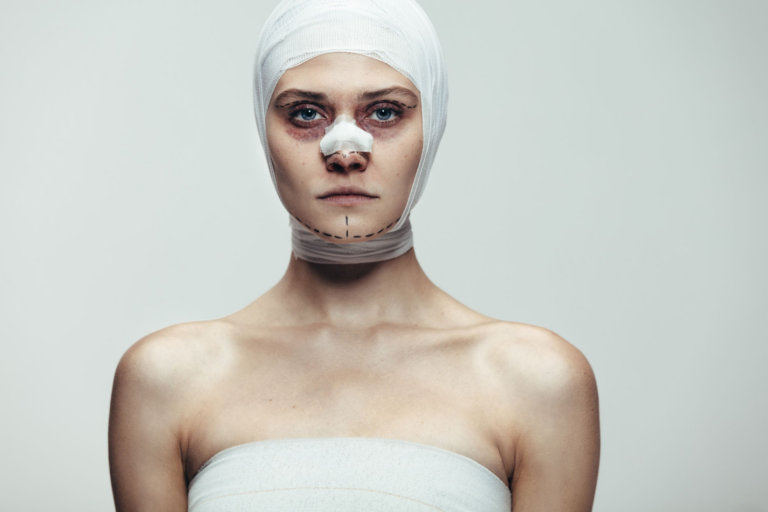 Una mujer con hematomas visibles en el rostro y vendajes, probablemente después de una cirugía, mirando directamente a la cámara con una expresión neutral.