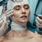 Een persoon met verband om het hoofd en chirurgische markeringen in het gezicht ondergaat een medische ingreep. Er zijn medische professionals aanwezig, één met een injectiespuit en een ander met een chirurgisch instrument.