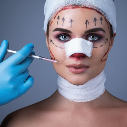 A person undergoing a cosmetic procedure with surgical markings on their face and a syringe being held near their cheek by a medical professional wearing blue gloves.