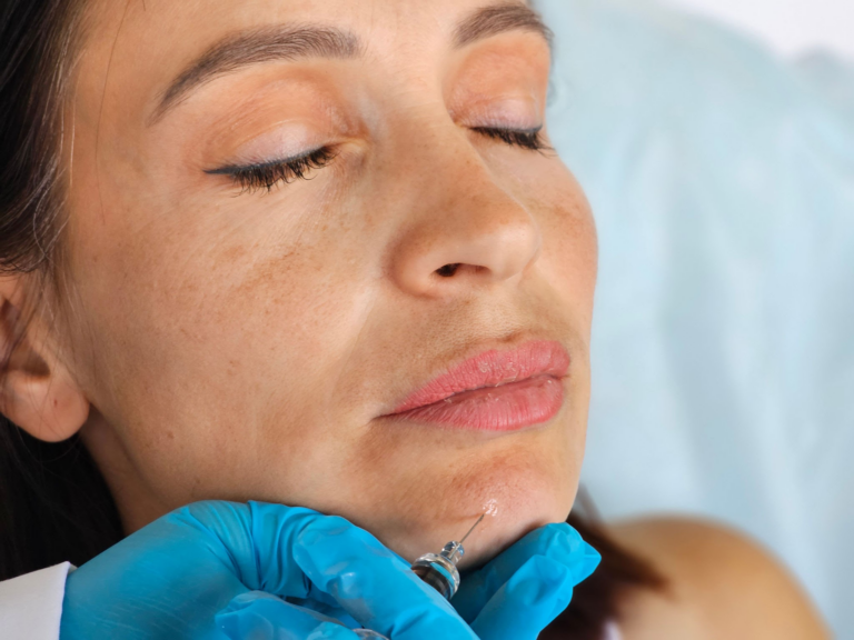 Primer plano de una mujer recibiendo una inyección facial, probablemente un tratamiento cosmético. La mujer tiene los ojos cerrados y un profesional de la salud con guantes azules le administra la inyección cerca de la mandíbula.