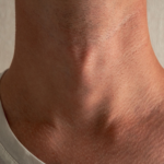 Close-up van de nek van een persoon, met huidtextuur en details. De afbeelding benadrukt de natuurlijke plooien en contouren van de nek, met subtiele schaduwen die over de huid vallen. De persoon draagt een lichtgekleurd shirt met een licht zichtbare kraag.