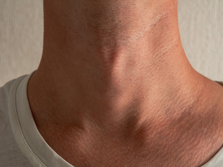 Primer plano del cuello de una persona, que muestra la textura y los detalles de la piel. La imagen resalta los pliegues y contornos naturales del cuello, con sutiles sombras proyectadas sobre la piel. La persona lleva una camisa clara con el cuello ligeramente visible.