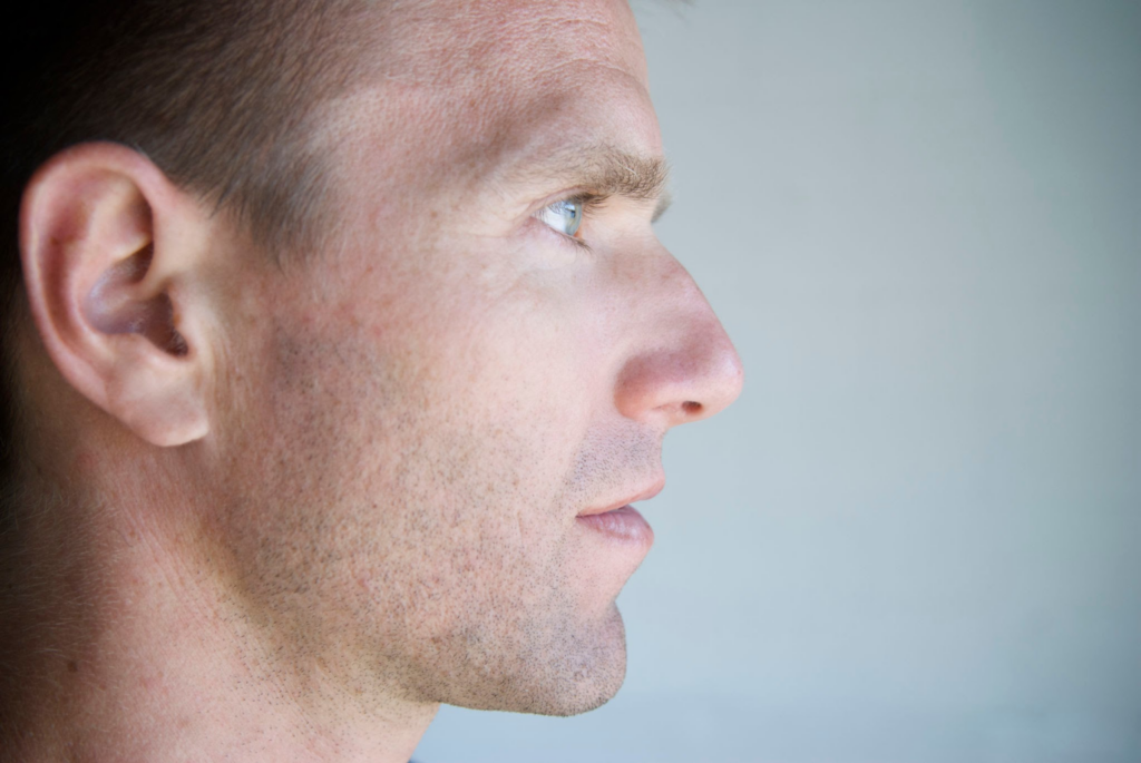 Can Facial Masculinization Surgery Give Me a More Defined and Masculine Brow Bone? 1