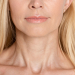 Gros plan du bas du visage et du cou d'une femme, mettant l'accent sur le menton, les lèvres et la texture de la peau. L'image met en valeur les traits du visage et l'état de la peau.