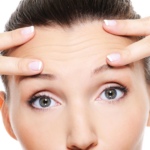endoscopic forehead lift cost